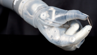 FDA Approves First Prosthesis Controlled by Muscle Electrical Signals